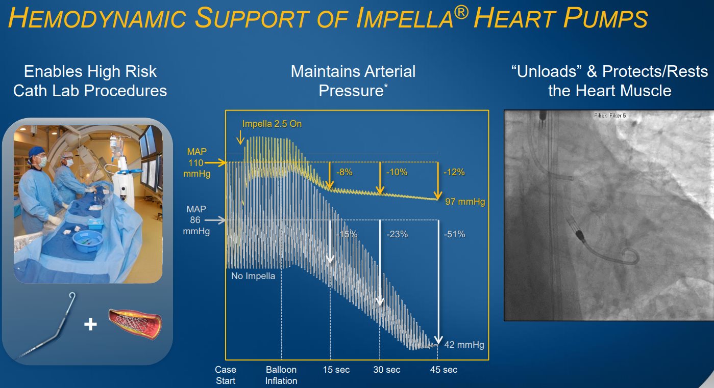 ABIOMED-HEMODYNAMIC-Support-of-Impella-Heart-Pumps